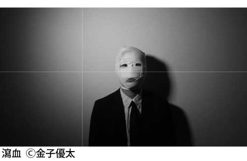 瀉血の写真